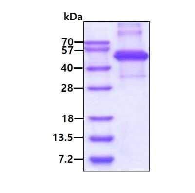 SDS-PAGE: Recombinant Human KLF12 His Protein [NBP2-51837]